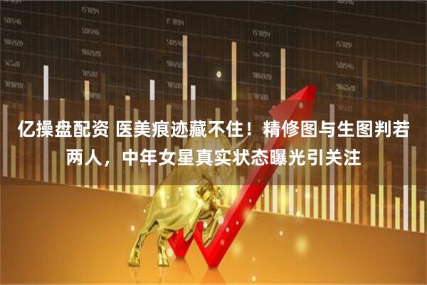亿操盘配资 医美痕迹藏不住！精修图与生图判若两人，中年女星真实状态曝光引关注
